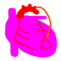 心臓外科の日々