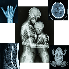 レントゲン写真